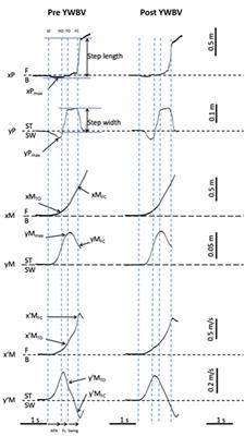 Acute Effects of Whole-Body Vibration on the Postural Organization of Gait Initiation in Young Adults and Elderly: A Randomized Sham Intervention Study